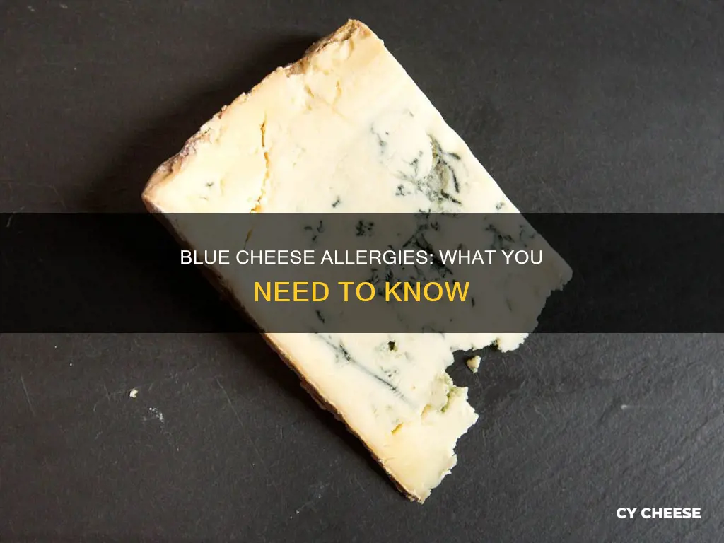 am i allergic to blue cheese
