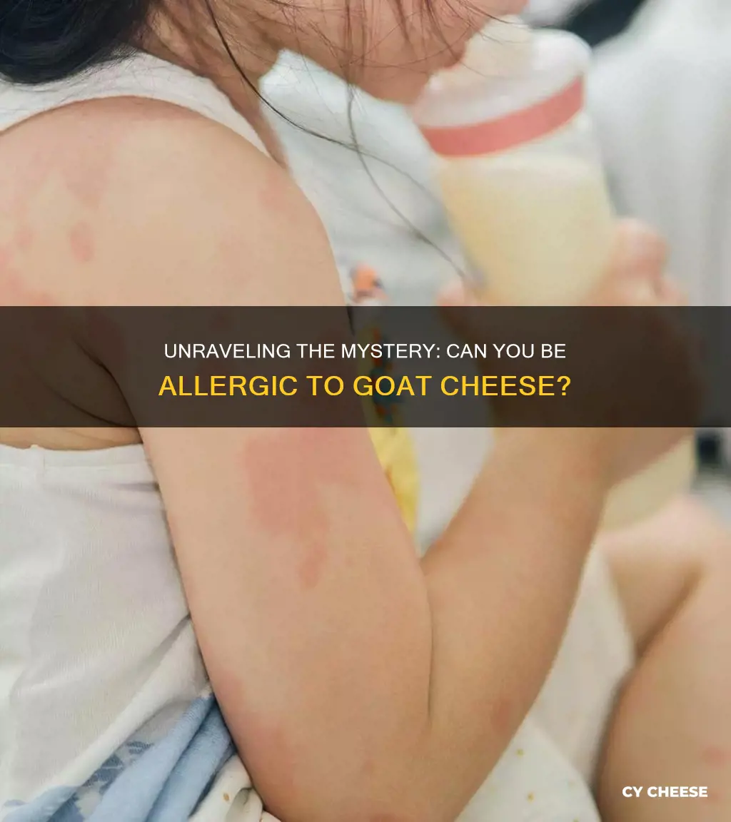 are people allergic to goat cheese