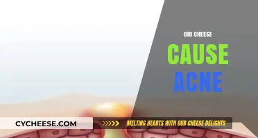 Cheese and Acne: Unraveling the Myth Behind Dairy's Impact