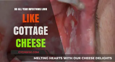 Do All Year-Round Infections Resemble Cottage Cheese? Unveiling the Truth