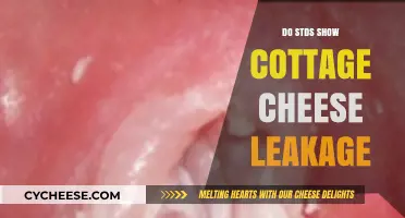 Understanding Cottage Cheese-Like Discharge: STD Symptoms Explained