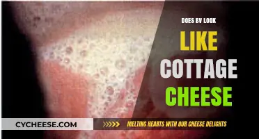 Does BV Discharge Resemble Cottage Cheese? Understanding Symptoms and Differences