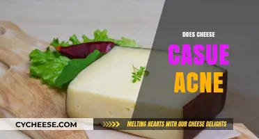 Does Cheese Cause Acne? Unraveling the Dairy-Skin Connection