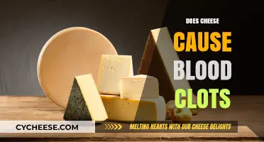 Does Cheese Cause Blood Clots? Unraveling the Dairy Dilemma