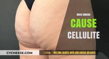 Does Cheese Cause Cellulite? Separating Fact from Fiction in Diet Myths