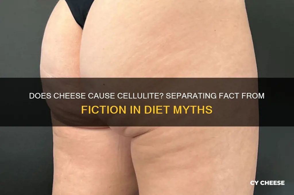 does cheese cause cellulite