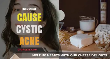 Does Cheese Trigger Cystic Acne? Unraveling the Dairy-Skin Connection