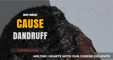 Does Cheese Cause Dandruff? Unraveling the Myth and Facts