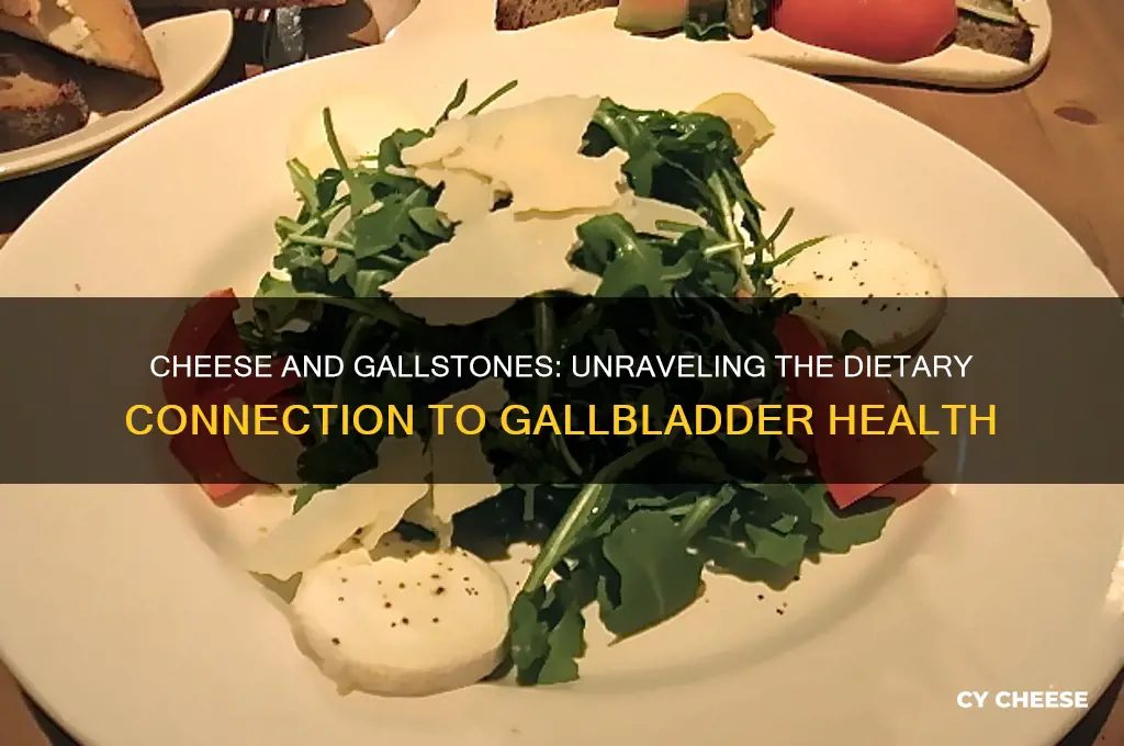 does cheese cause gallstones