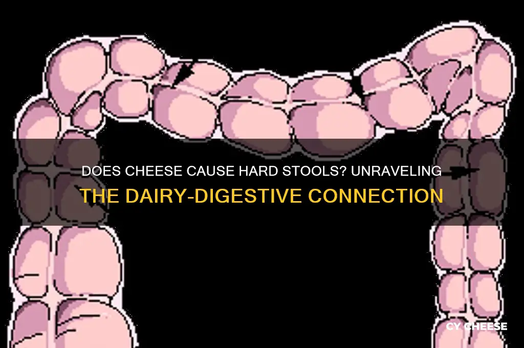 does cheese cause hard stools