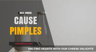 Cheese and Acne: Unraveling the Myth of Pimple-Causing Dairy