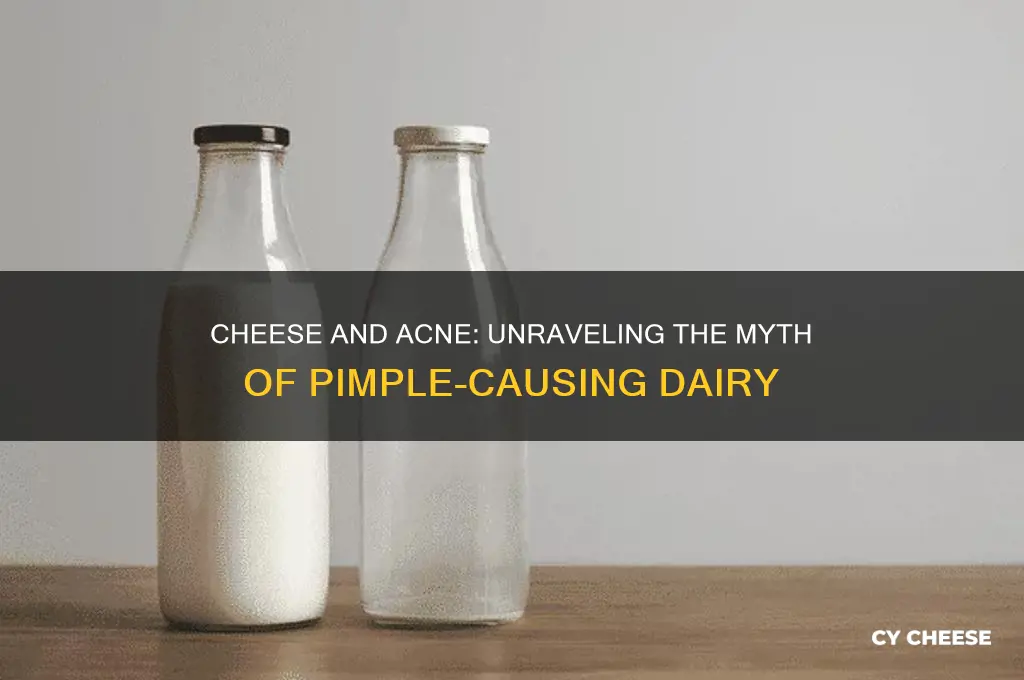 does cheese cause pimples