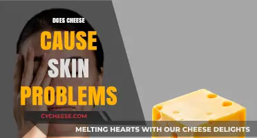 Cheese and Skin: Uncovering the Truth Behind Acne and Dairy