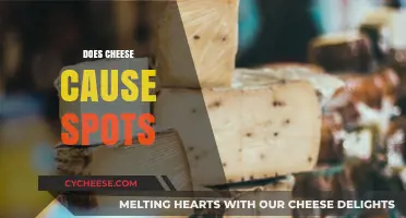 Cheese and Acne: Unraveling the Myth of Dairy-Induced Spots