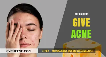 Does Cheese Cause Acne? Uncovering the Truth Behind Dairy and Skin
