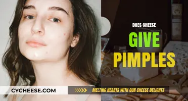Does Cheese Cause Acne? Unraveling the Dairy-Pimple Connection