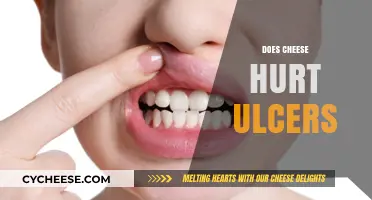 Cheese and Ulcers: Debunking Myths and Understanding Dietary Impact