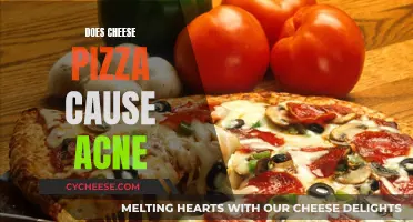 Cheese Pizza: Friend or Foe in Acne Battle?