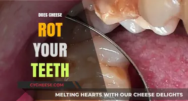 Cheese and Dental Health: Does It Rot Your Teeth?