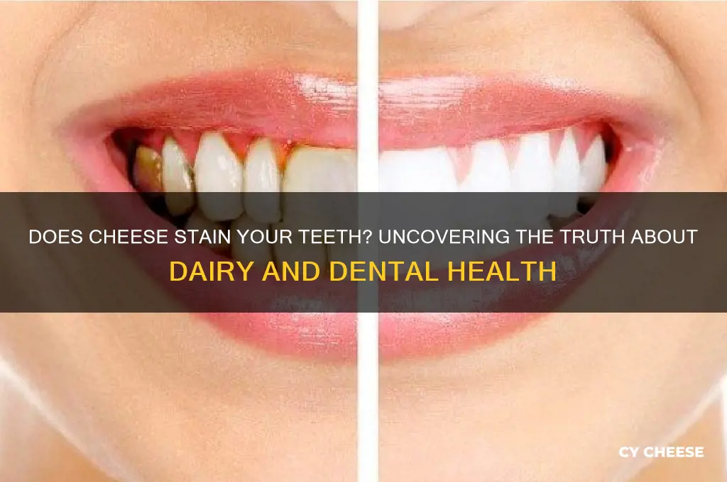 does cheese stain your teeth