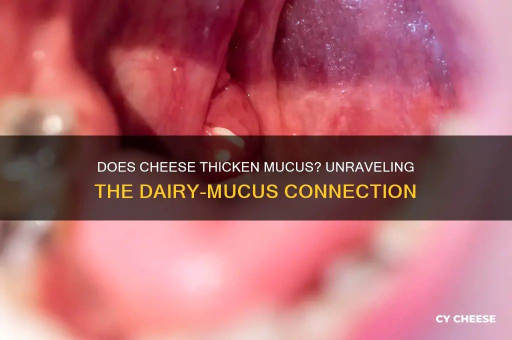 does cheese thicken mucus