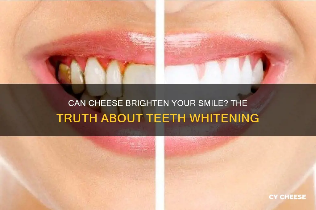 does cheese whiten teeth