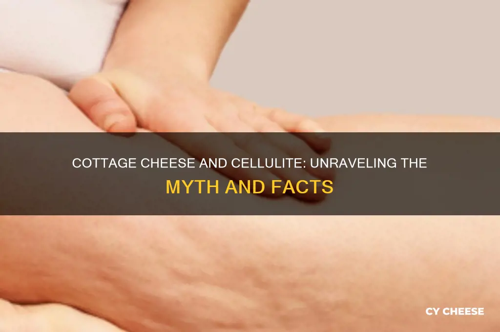 does cottage cheese cause cellulite