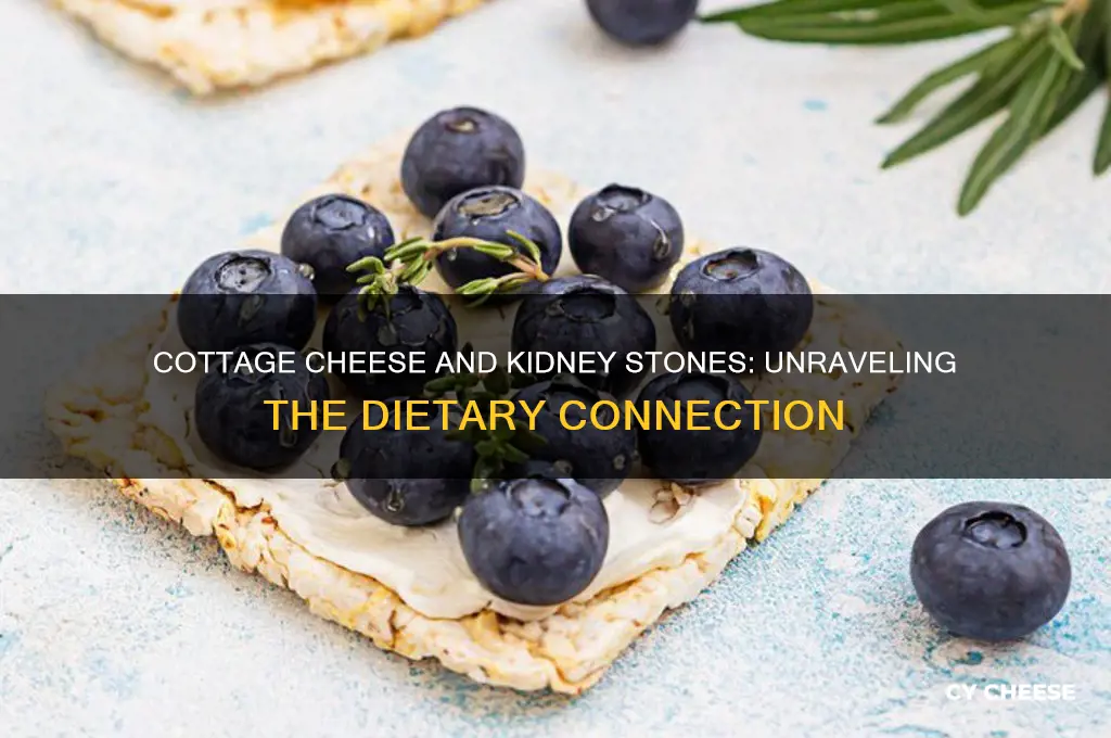 does cottage cheese cause kidney stones