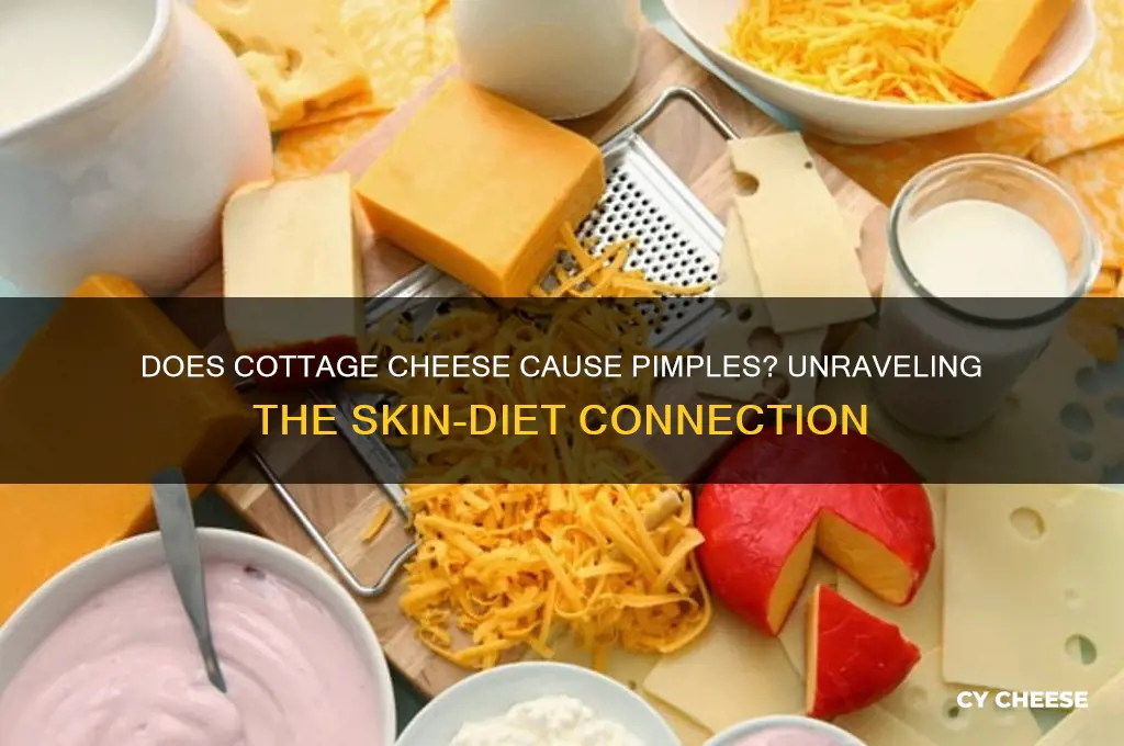 does cottage cheese cause pimples