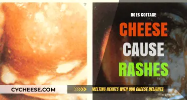 Cottage Cheese and Skin Rashes: Unraveling the Truth Behind the Myth