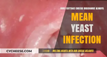 Cottage Cheese Discharge: Yeast Infection or Something Else?