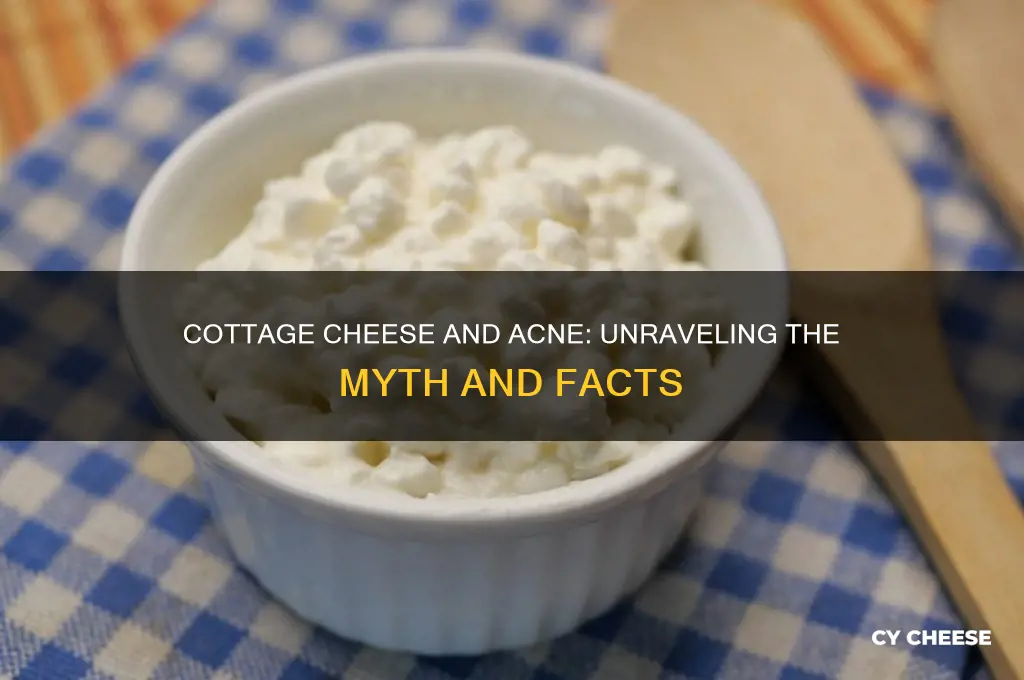does cottage cheese give you acne