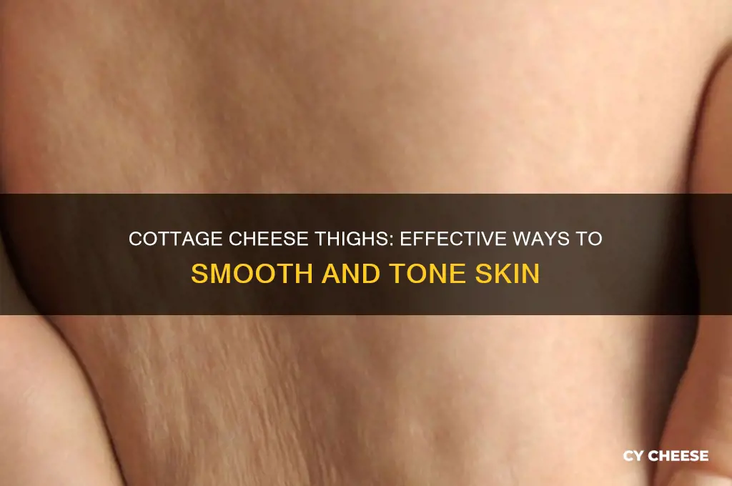 does cottage cheese thighs go away