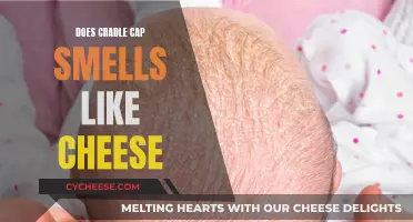 Cradle Cap: The Cheesy Smell Mystery Solved