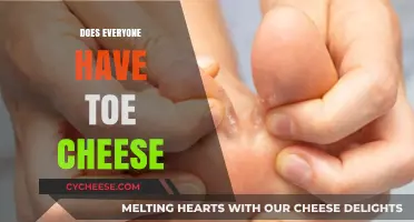 Toe Cheese: A Universal Phenomenon or Just a Myth?
