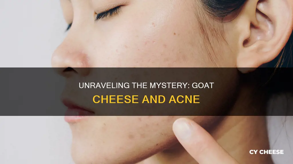 does goat cheese cause acne