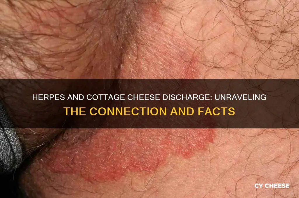 does herpes cause cottage cheese discharge