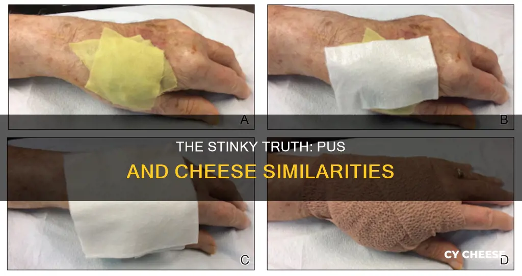 does pus smell like cheese