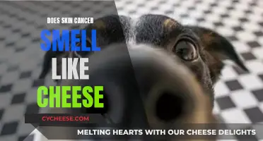 Skin Cancer and the Cheese Odor Mystery