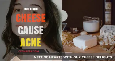 Does String Cheese Cause Acne? Unraveling the Dairy-Skin Connection