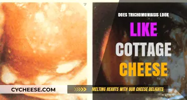 Trichomoniasis vs. Cottage Cheese Discharge: What’s the Difference?