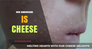 Is Cheese Comedogenic? Uncovering Dairy's Impact on Your Skin