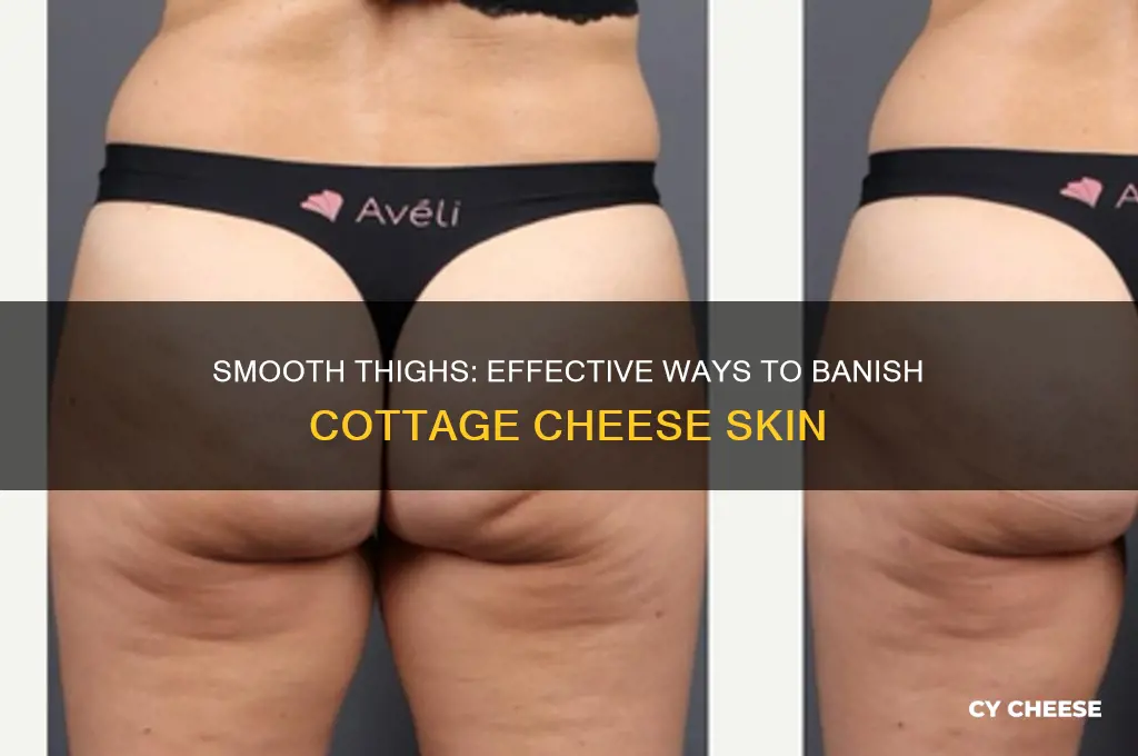 how do i get rid of my cottage cheese thighs