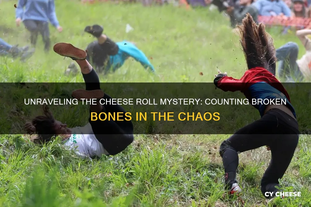 how many broken bones in the cheese roll