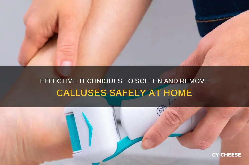 how to cheese callus