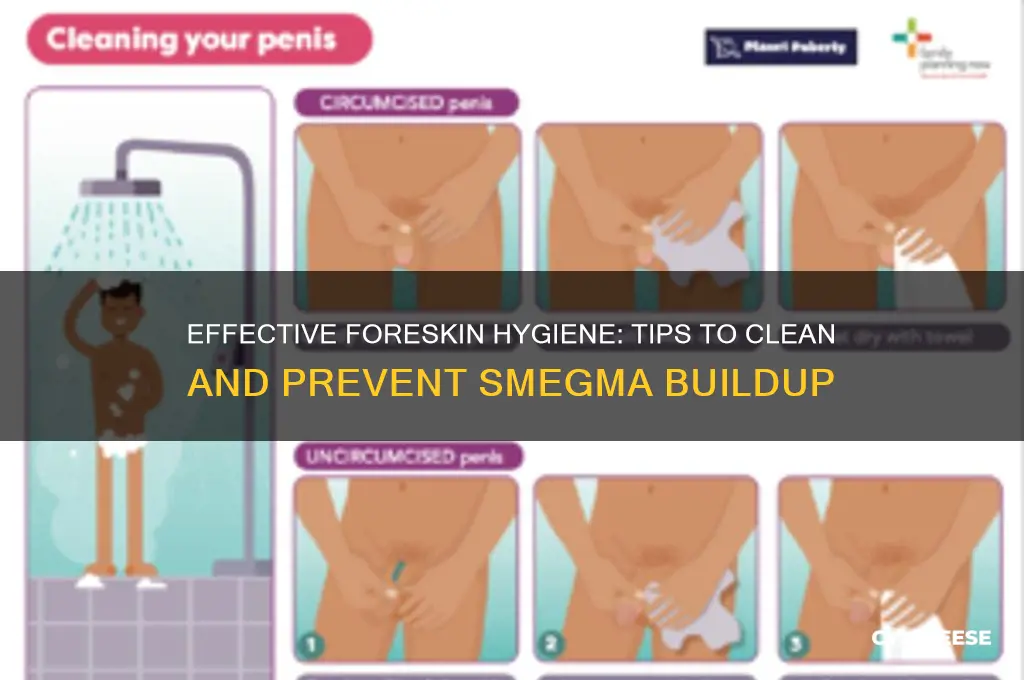 how to clean foreskin cheese