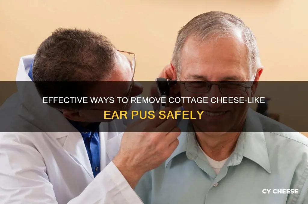 how to get cottage cheese pus out of ear