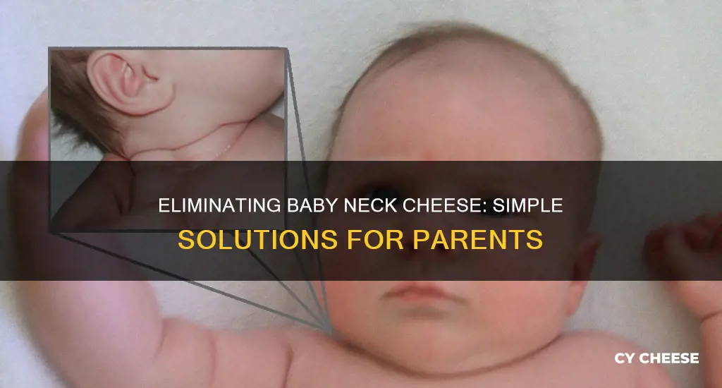 how to get rid of baby neck cheese