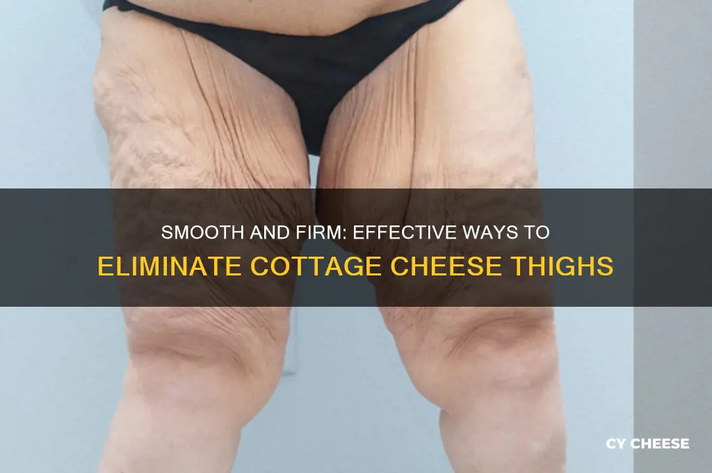 how to get rid of cottage cheese ass