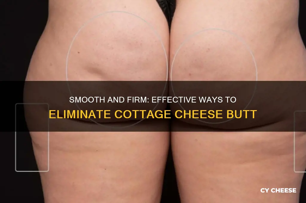 how to get rid of cottage cheese butt